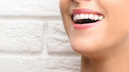 Il nuovo orientamento all’estetica e la ricerca dei “denti bianchi”