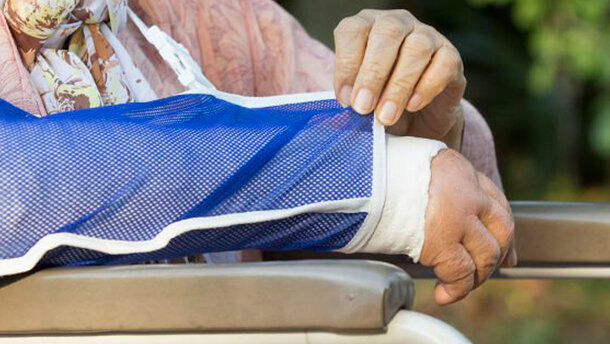 Donne inclini a fratture ossee corrono un maggior rischio di malattia parodontale