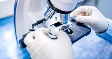 Scienziati neozelandesi sviluppano un nuovo metodo per preservare i denti cariati