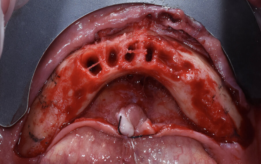 Fig. 5 - Visione occlusale.