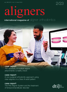 aligners international No. 2, 2023 aligners international No. 2, 2023