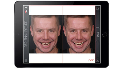 Kdo potřebuje Digital Smile Design (DSD)?