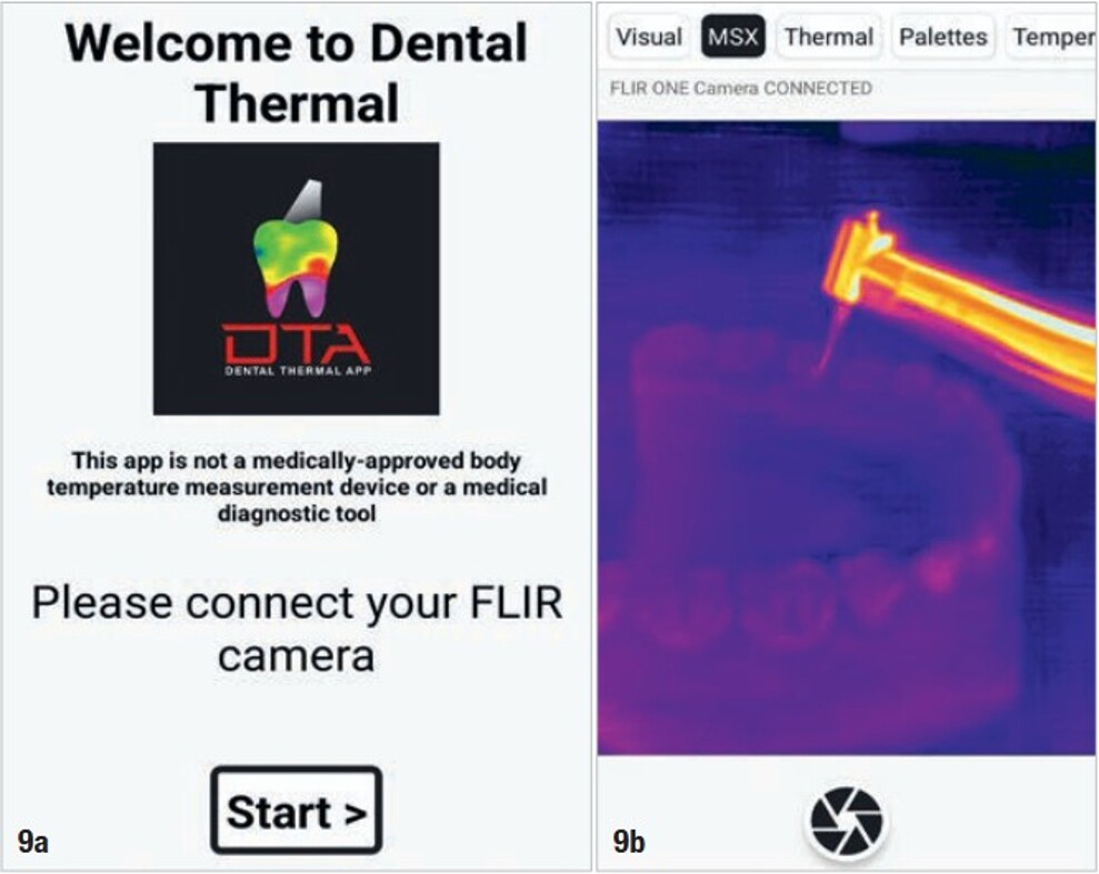 Figs. 9a & b: Dental Thermal App welcome screen before connection of the FLIR camera (a) and the connected thermal imaging view during capture mode (b).