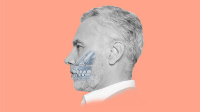Advancing zygomatic implantology: Nobel Biocare’s Zygoma Academy drives clinical excellence Advancing zygomatic implantology: Nobel Biocare’s Zygoma Academy drives clinical excellence