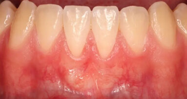 Natasha Lioubavina: “Samen kunnen we gecontroleerde behandelingen aanbieden met betere resultaten”