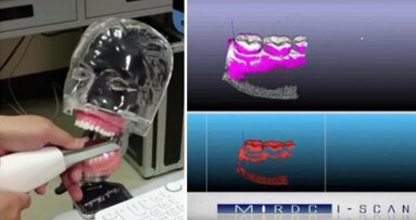 Taiwan: Apresentada nova relação custo-benefício da tecnologia de digitalização intraoral de laser azul