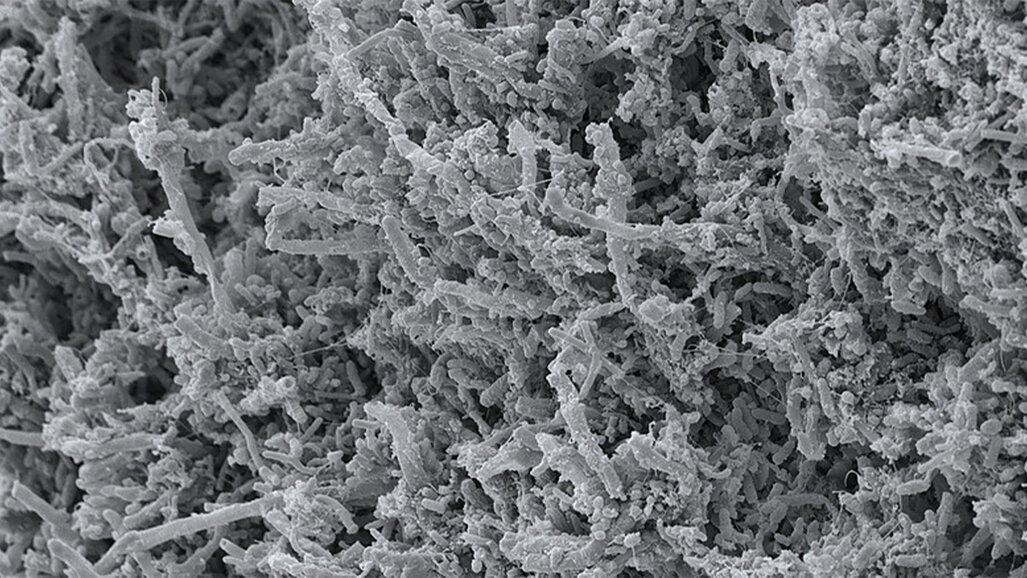 Projekt „MinOroBiome“ untersucht bakterielle Biofilme im Mund