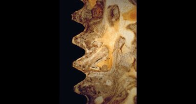 Metodo agli elementi finiti in implantologia: stato dell’arte e direzioni future