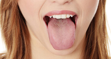 Trained nose can detect oral disease on bad breath