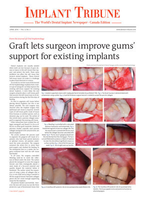 Implant Tribune Canada No. 2, 2016