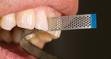 Tiras diamantadas para obturación y ortodoncia