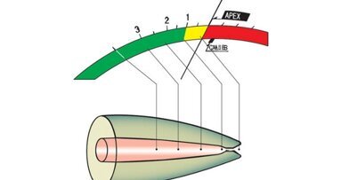 Résultats du sondage sur les localisateurs d'apex