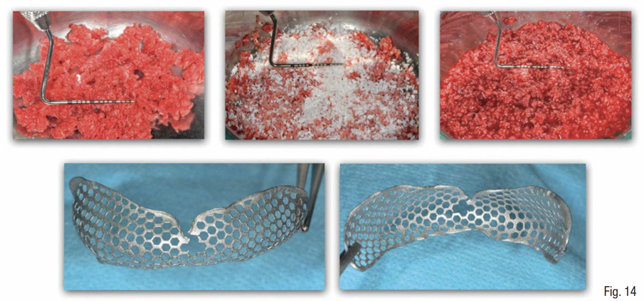 Fig. 14