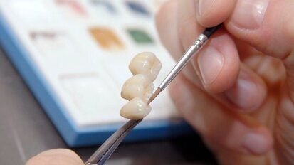 Pracownia protetyczna musi być wszechstronna