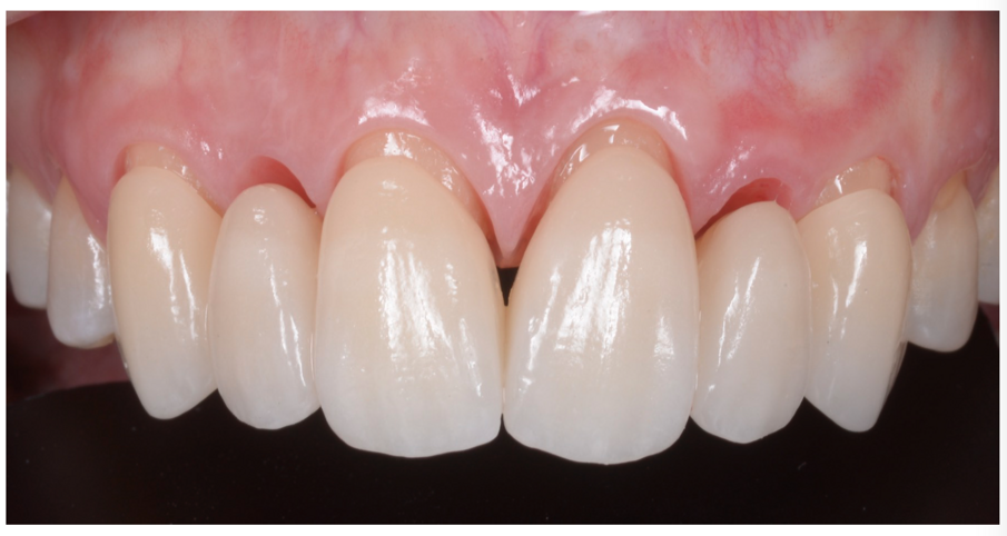 Fig. 28_Inserimento del lavoro definitivo.