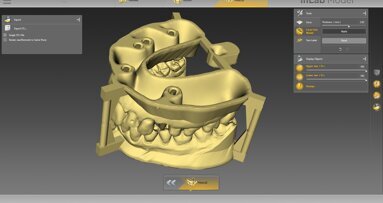 Nuove indicazioni, più funzioni: si aggiorna il software inLab 18.0