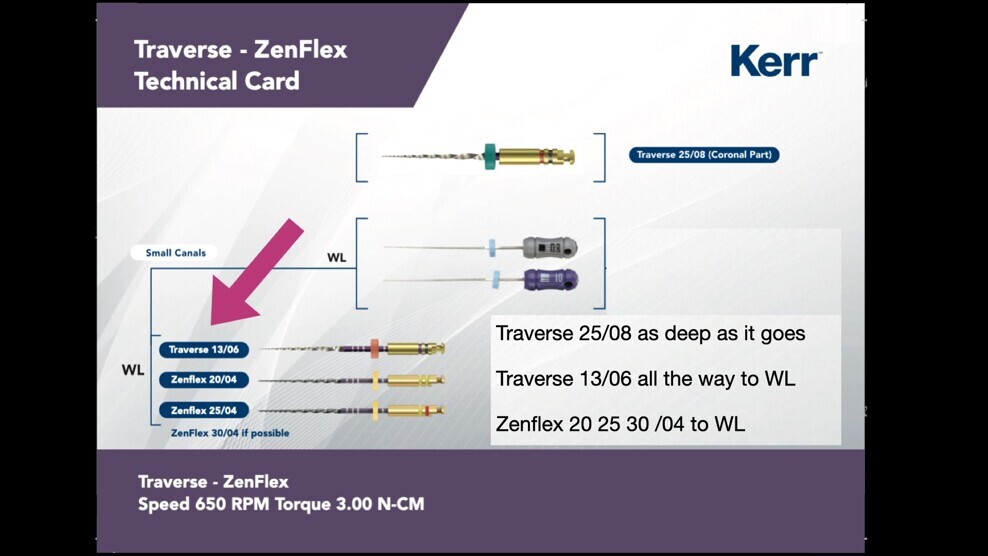 Fig. 7: The ZenFlex and Traverse files (Kerr Endodontics).