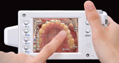 Webinaire : une nouvelle option pour la photographie dentaire