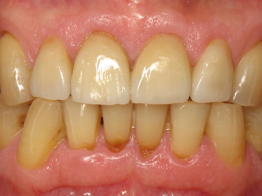 Fig. 1: Final situation.