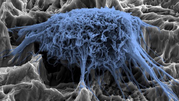 Pesquisadores desenvolvem novo revestimento para evitar infecções por implante dentário