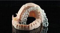 Contemporary provisionalisation with 3D printing: New approaches to familiar clinical challenges