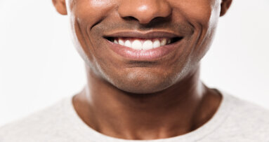 Odontologia Estética cresceu mais de 560% em 2021