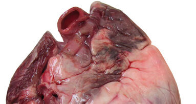 Coronary heart disease patients with no teeth have nearly double risk of death