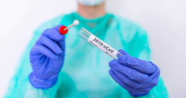 Testiranje stomatoloških pacijenata na SARS-CoV-2