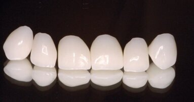 Co CAD/CAM zmienia w gabinecie