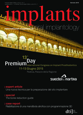 implants Italy No. 1, 2015 implants Italy No. 1, 2015