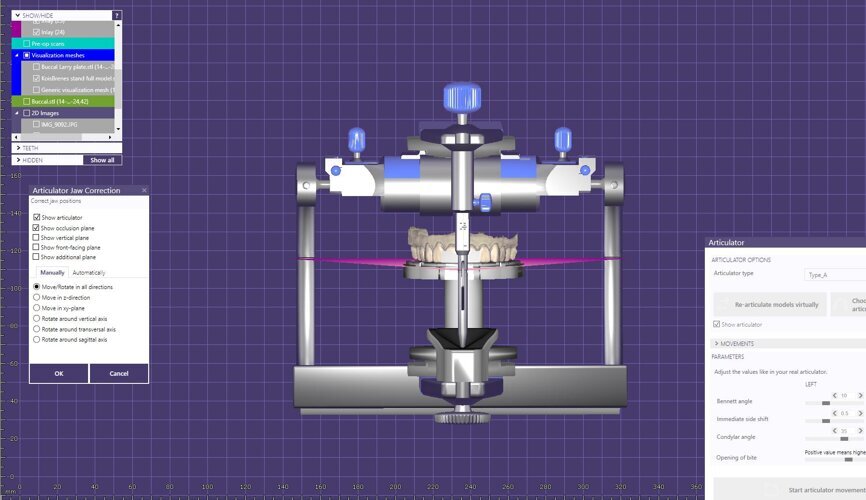 Fig. 15: Virtual articulator.