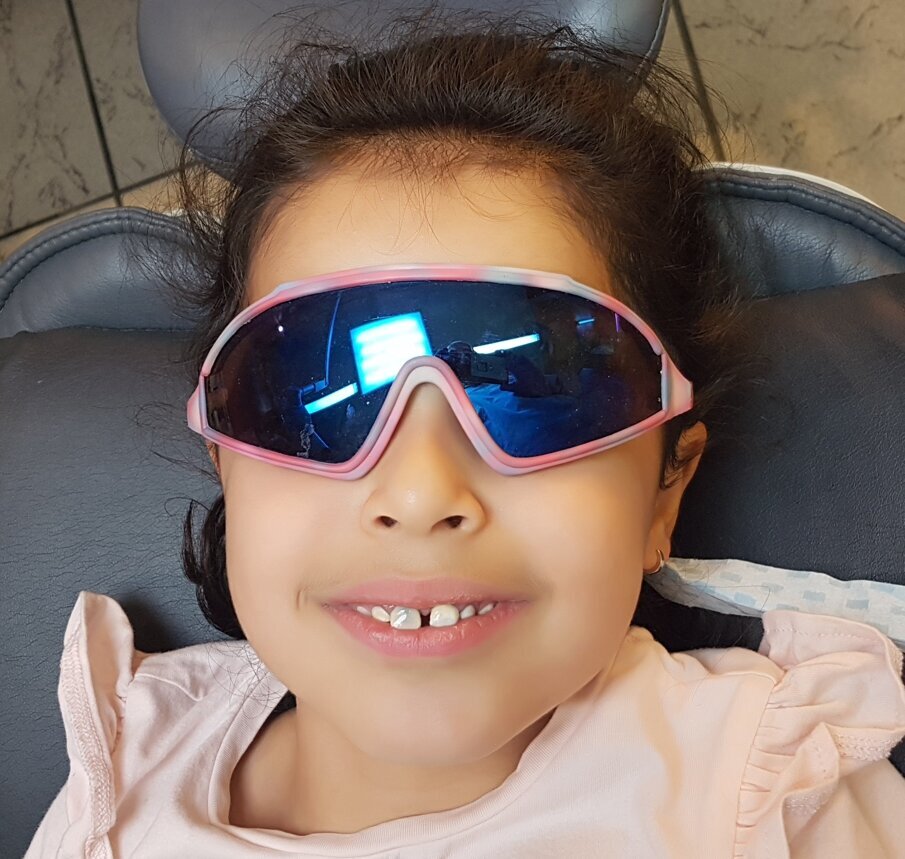 Afbeelding 3. Maskering naar tevredenheid door adhesieve behandeling van de zwarte verkleuring na twee jaar zonder toepassing van anesthesie.