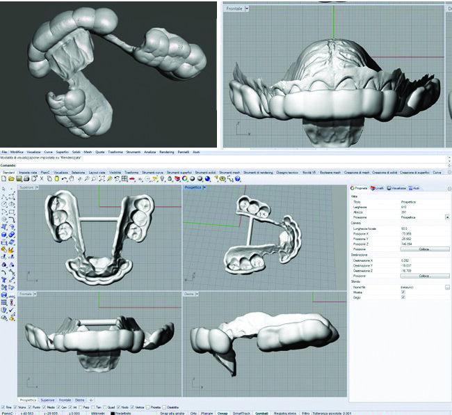 Fig. 11_Dispositivo dell’arcata superiore.