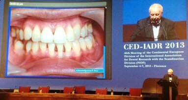 Ipersensibilità dentinale, salute orale e qualità di vita, quale relazione?