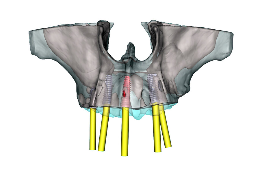 Fig. 8c