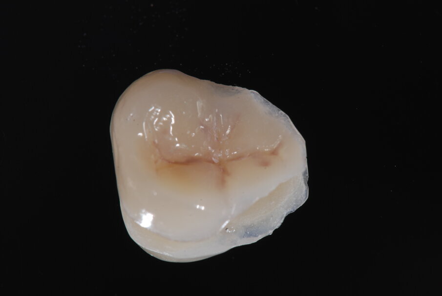 Fig. 29_Intarsio realizzato.