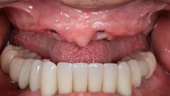 ¿Qué es, cómo funciona y para qué sirve la fotogrametría?