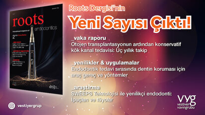 Çaylar Hazırsa Roots Dergisi’ne Yakından Bakalım