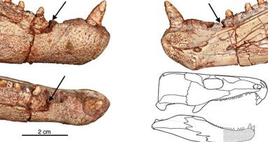 Des chercheurs découvrent le plus vieux mal de dents