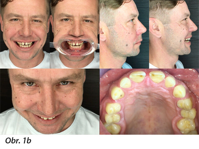 Obr. 1b: Výběr snímků získaných z videa zhotoveného mobilním telefonem. Tyto možnosti dávají velkou svobodu ve výběru optimálních snímků k DSD projektování.