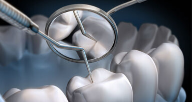 Mit Aufklärungskampagne gegen Parodontitis