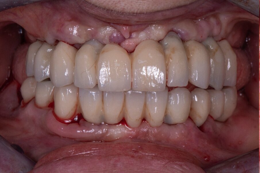 Fig. 10_Risultato finale.