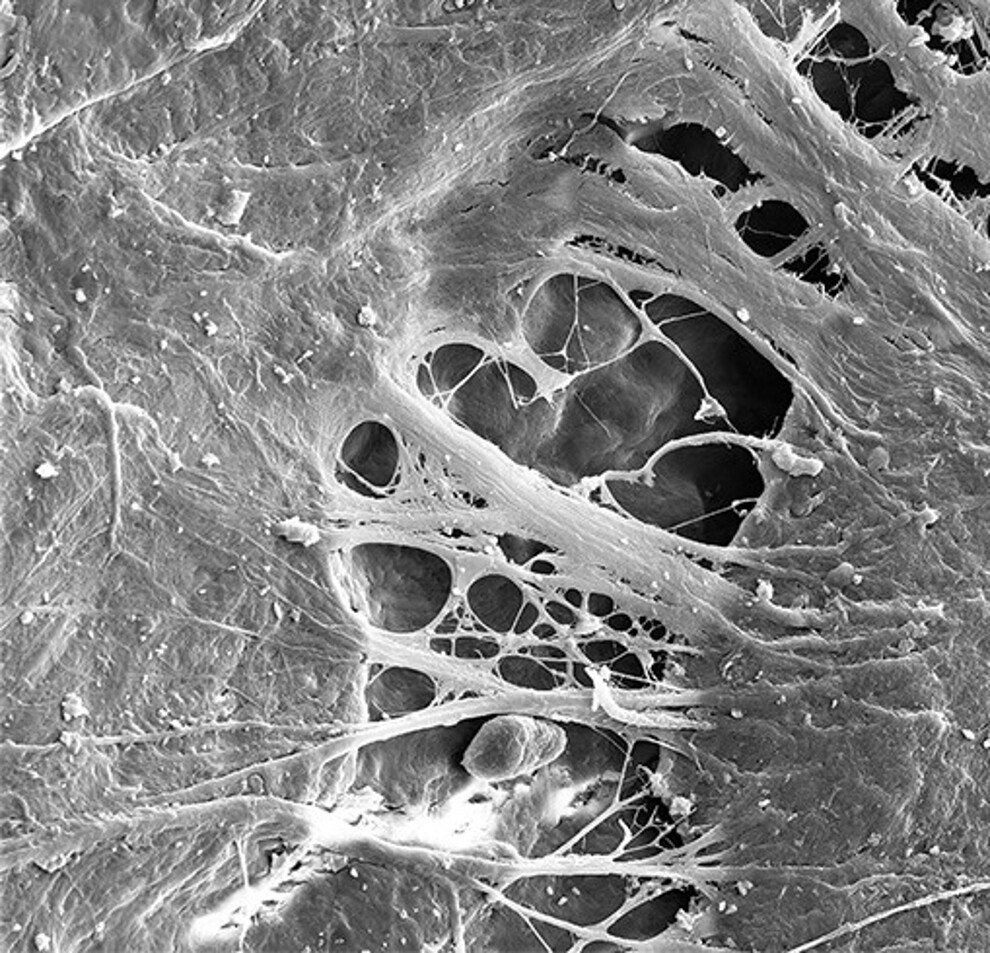 Fig. 1 : Micrographie électronique à balayage illustrant l’interface entre Patent Symbionic Teeth et les tissus mous environnants, mettant en évidence l’intégration et la continuité structurale au niveau de la jonction tissulaire. (Photo : Dr Roland Glauser)