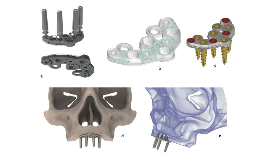 Fig. 1 - Struttura dei diversi dispositivi.