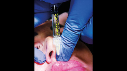 Un accesso semplificato alla medicina  estetica per gli odontoiatri: la formazione integrata di F.Aesthetic patrocinata SIMEO