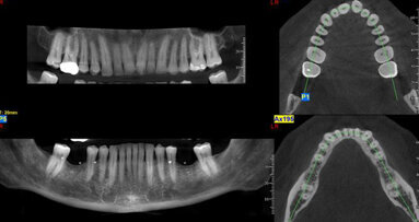 Mobile CBVI vans give dentists benefits of the technology without the cost