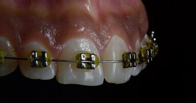 Dental photography school releases India's first dental calender