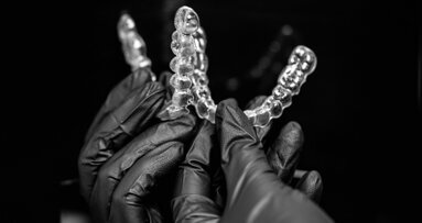 The digital aligner revolution