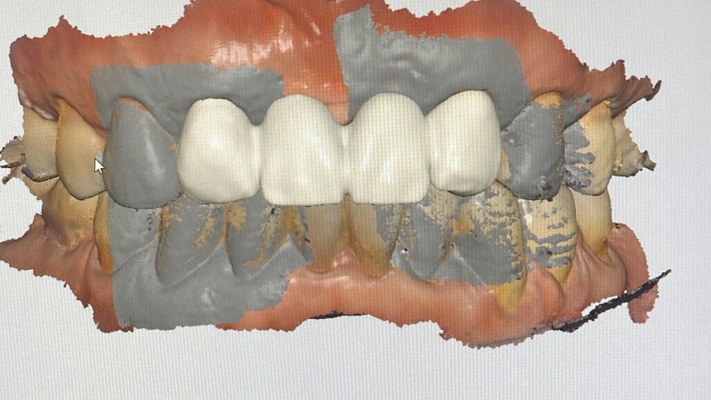 传统牙医的数字化转型：掌握关键的十大要点”