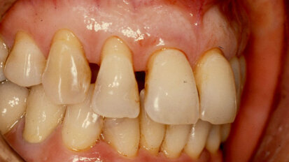 “Malpractice” e conoscenze specifiche del CTU: un caso paradigmatico